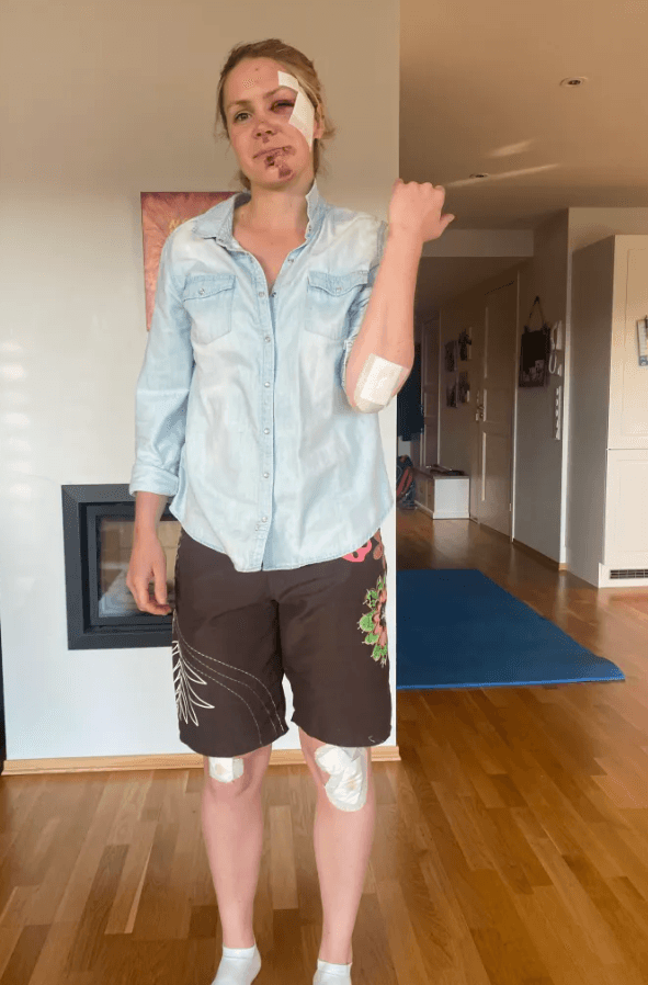 Karoline Knotten blessure